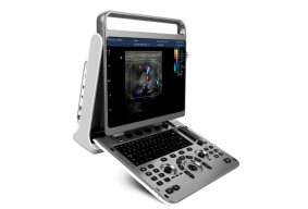 УЗИ сканер Chison SonoTouch 60 OB